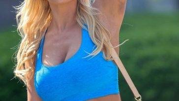 Busty Christine McGuinness Shows Off Extensive Bruising on Her Arms Looking Hot in a Blue Top on fanspics.net